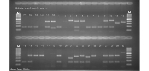 Przykładowy elektroforegram produktów reakcji multipleks PCR dla genów mecA,  mecALGA251/ mecC, LukF-PV i spa